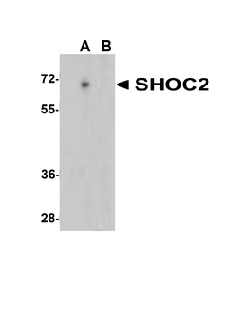 SHOC2 Antibody