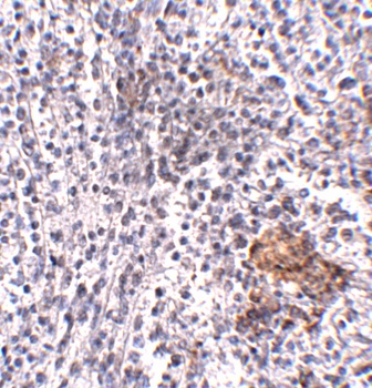 SHOC2 Antibody