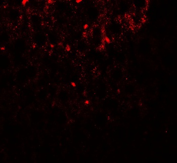 SHBG Antibody