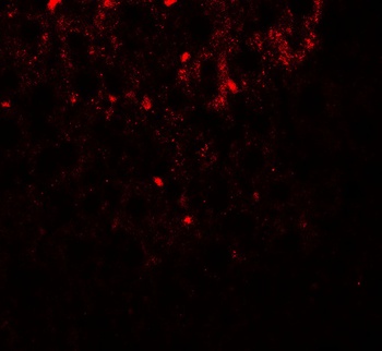 SHBG Antibody