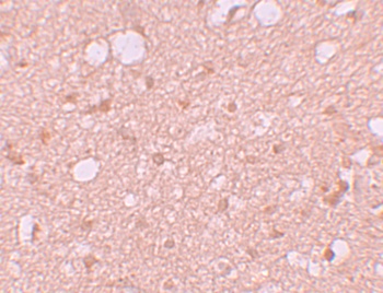 SESTD1 Antibody