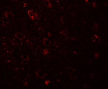 SESTD1 Antibody