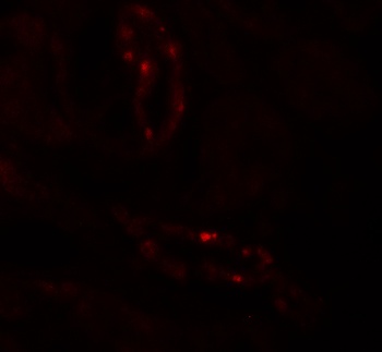 SCUBE3 Antibody