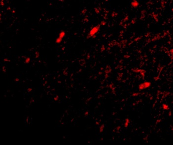 SCRAPPER Antibody