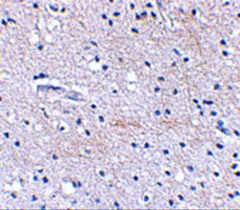 FBXL20 Antibody