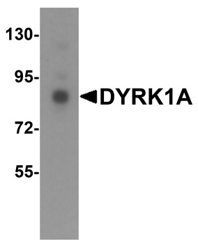 DYRK1A Antibody