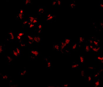 SCARA5 Antibody
