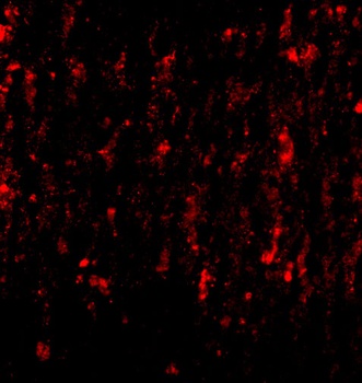 SATB2 Antibody