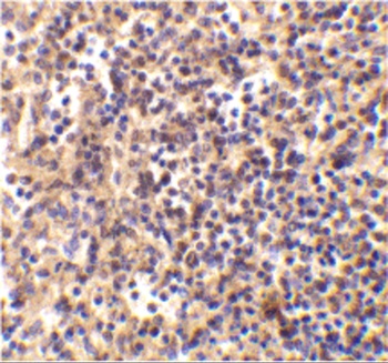 DNASE2 Antibody