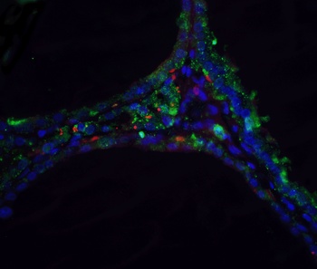DNASE2 Antibody