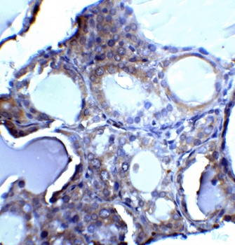 DNASE2 Antibody