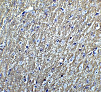 DCLK3 Antibody