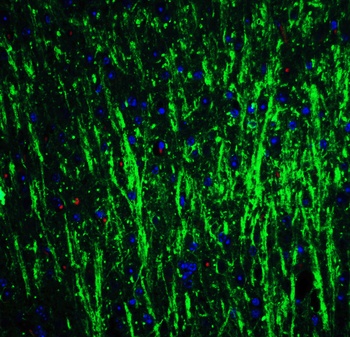 DCLK3 Antibody