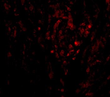 CIKS Antibody