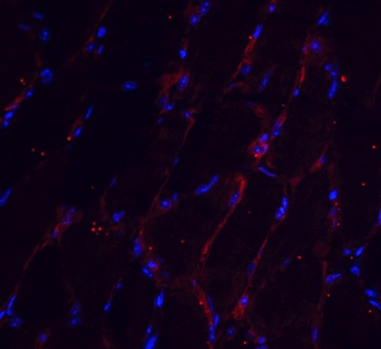 CHADL Antibody