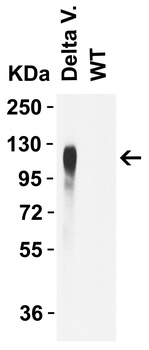 SARS-CoV-2 (COVID-19) Spike L452R Antibody (Delta Variant)