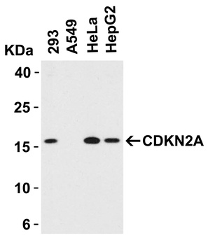 CDKN2A Antibody