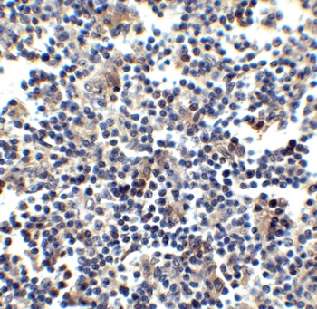 CCR5 Antibody