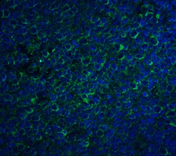 CCR5 Antibody
