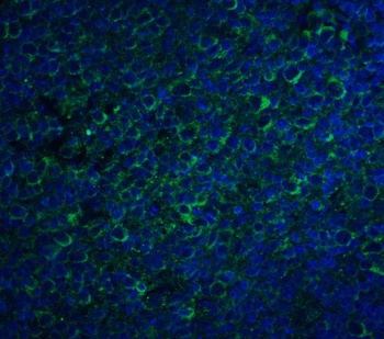 CCR5 Antibody