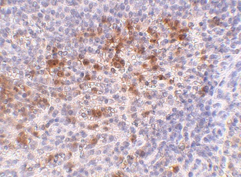 Cathelicidin Antibody
