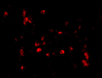 Cathelicidin Antibody