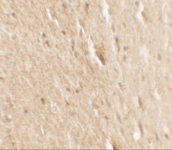 BRAF Antibody