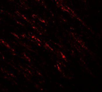 BRAF Antibody