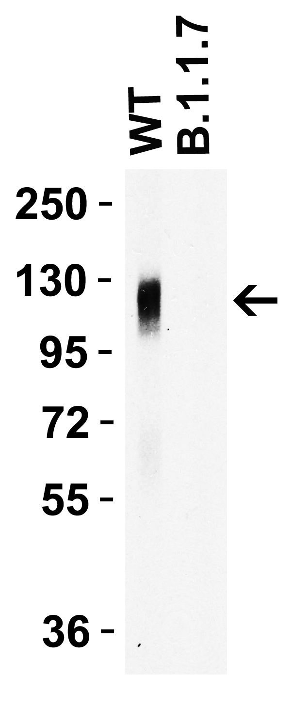 SARS-CoV-2 (COVID-19) Spike 681P Antibody [8G10C8]