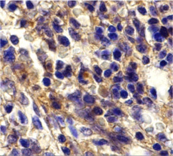 CXCR6 Antibody