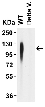 SARS-CoV-2 (COVID-19) Spike 156-157EF Antibody