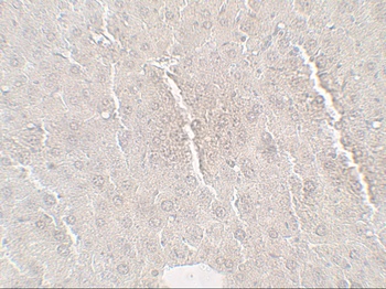 Betatrophin Antibody