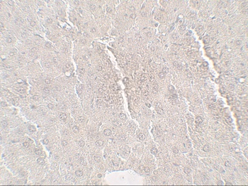 C19orf80 Antibody