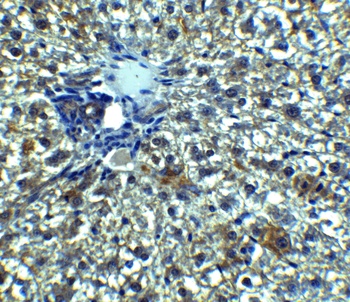 Betatrophin Antibody