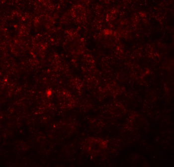 Betatrophin Antibody