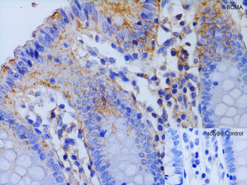 BCMA Antibody