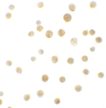 Bcl9L Antibody
