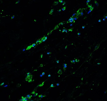 Bcl9L Antibody