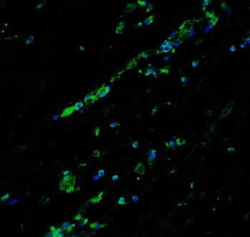 BCL9L Antibody