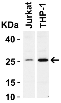 Bcl-2 Antibody