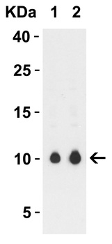 SARS-CoV-2 (COVID-19) ORF9c Antibody