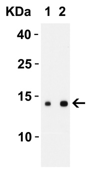 SARS-CoV-2 (COVID-19) ORF8 Antibody