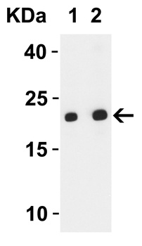 SARS-CoV-2 (COVID-19) ORF3b Antibody