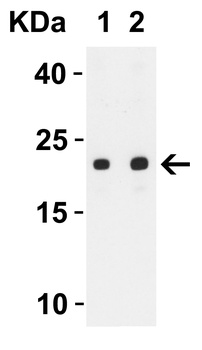 SARS-CoV-2 (COVID-19) ORF3b Antibody
