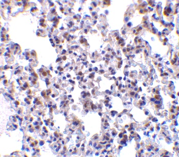 BCAP31 Antibody