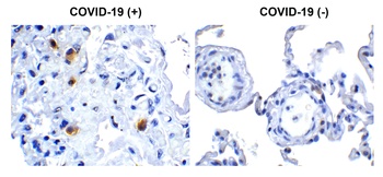 SARS-CoV-2 (COVID-19) NSP14 (ExoN) Antibody