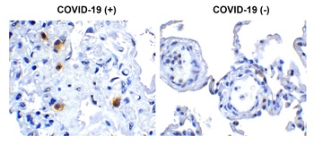 ExoN Antibody