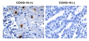 SARS-CoV-2 (COVID-19) NSP10 Antibody