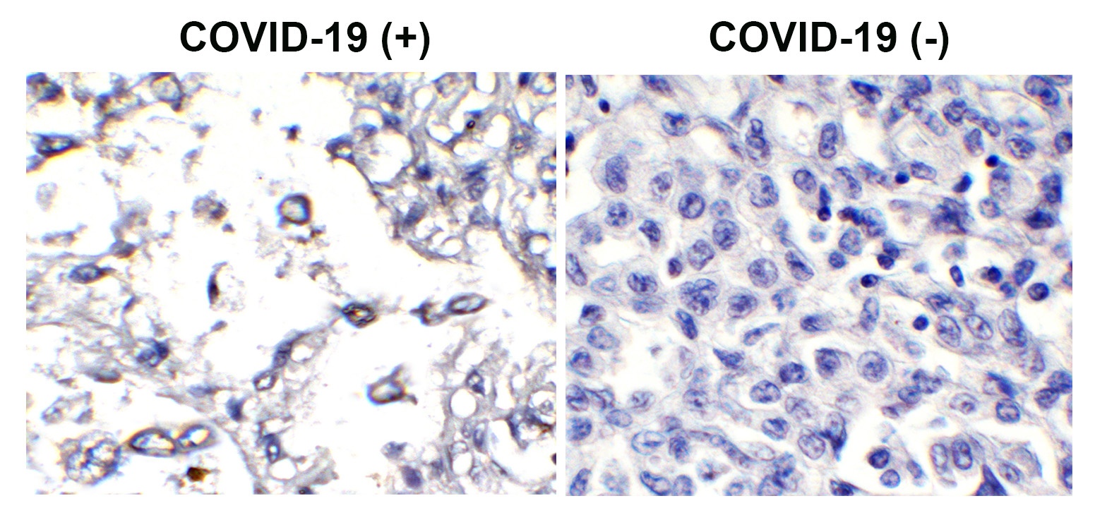 SARS-CoV-2 (COVID-19) Membrane Antibody (biotin)