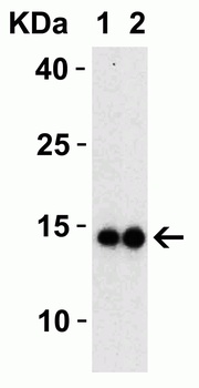 SARS-CoV-2 (COVID-19) Membrane Antibody